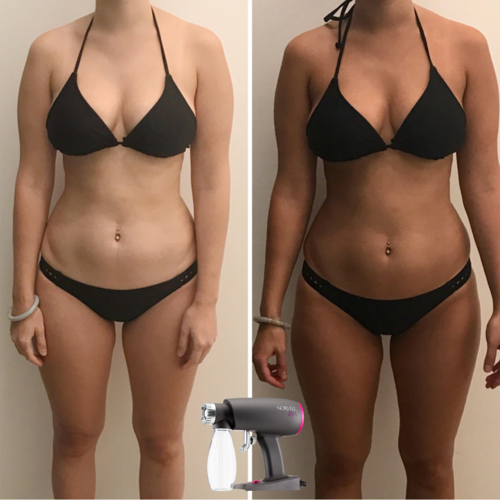 Impressive before and after results of a spray tan at Key Largo Tan & Spa, showcasing the effectiveness of sunless tanning.